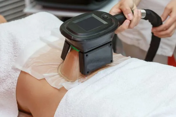 Image of person having fat freezing treatment to help weight gain Brighton
