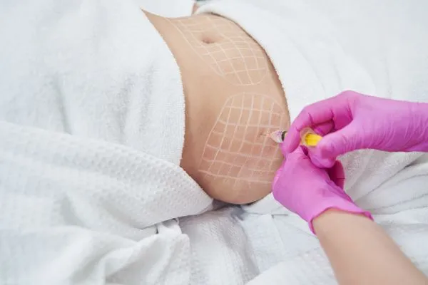 image of fat dissolving injections on love handles to help combat weight gain Brighton