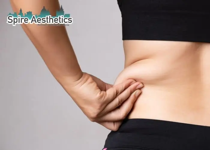 Image of woman pinching fat on their hips Brighton. Fat Freezing treatment