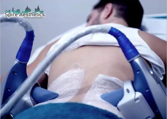 Man having fat freezing treatment done on love handles before a competitions Brighton to create a sculpted look.
