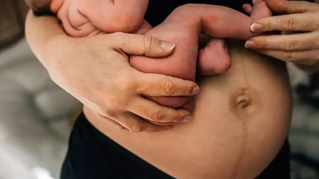 Why Is My Stomach Still Big After Pregnancy Brighton?